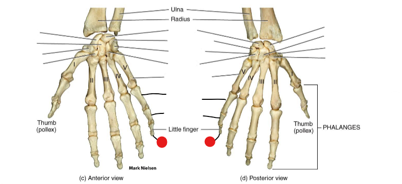 <p>Identify the structure pinned</p>