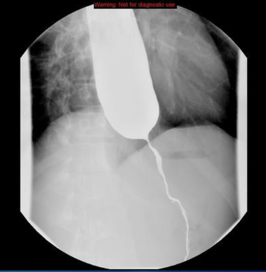 <p>continuous/pulsed x-ray beam passed through body to create real-time, moving images on a monitor </p>