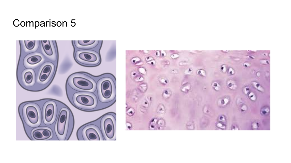 <p><strong>Hyaline Cartilage</strong></p>