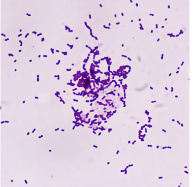 <p>Bacteria</p>