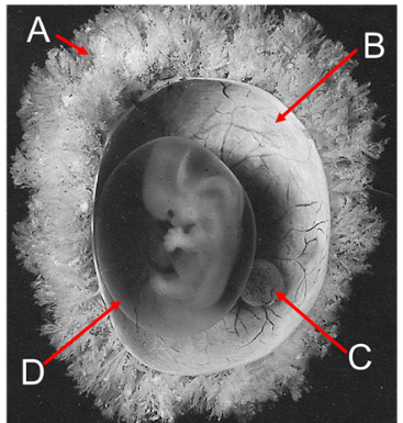 <p>Label A, B, C and D</p>