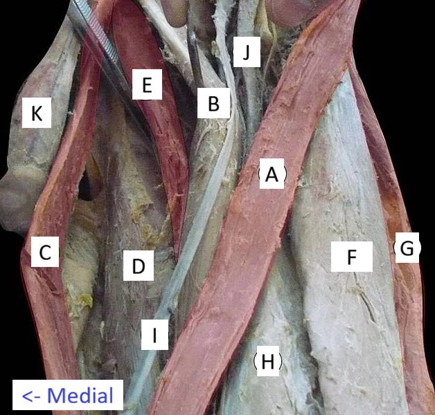 <p>I</p>