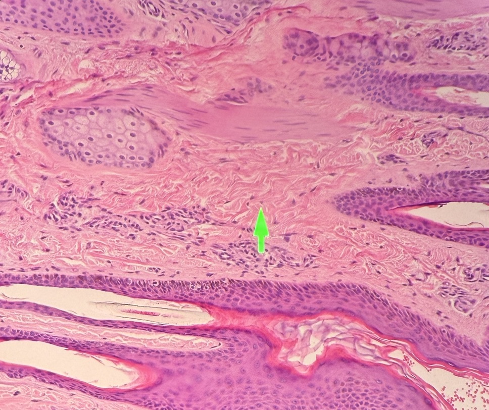 term image