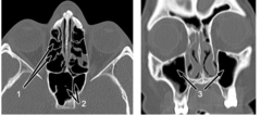 <p>Identify the structure at #1</p>