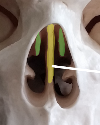 <p>What is upper green region highlighted on the ethmoid bone?</p>