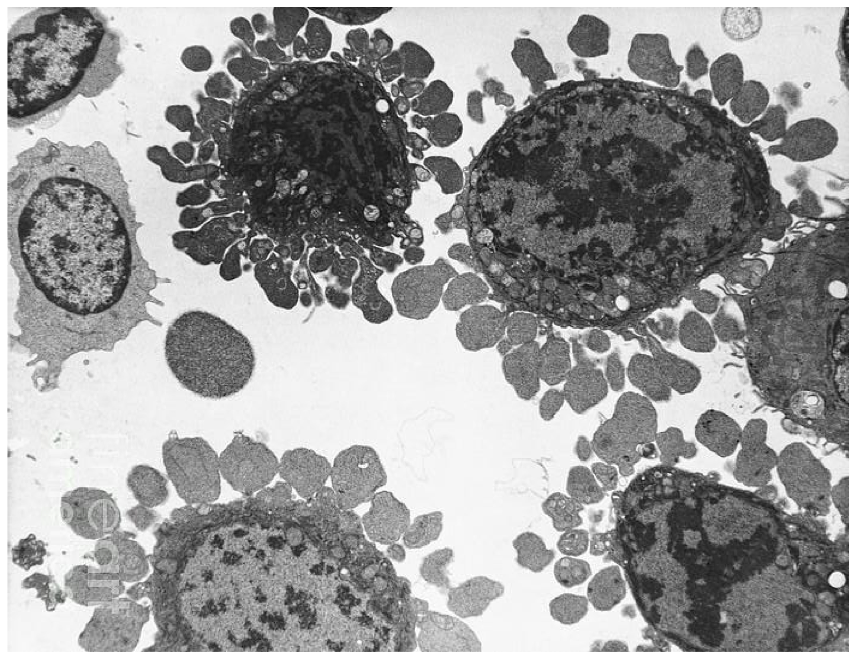 <p>Characteristic for apoptosis</p>