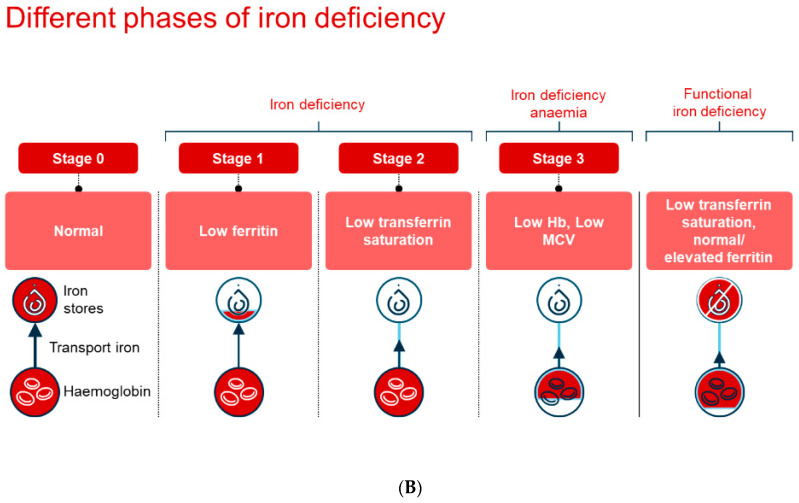 <p>At what stage of iron deficiency do signs and symptoms present?</p><p>A. Stage 2</p><p>B. Stage 3</p><p>C. Stage 4</p><p>D. Stage 5</p>