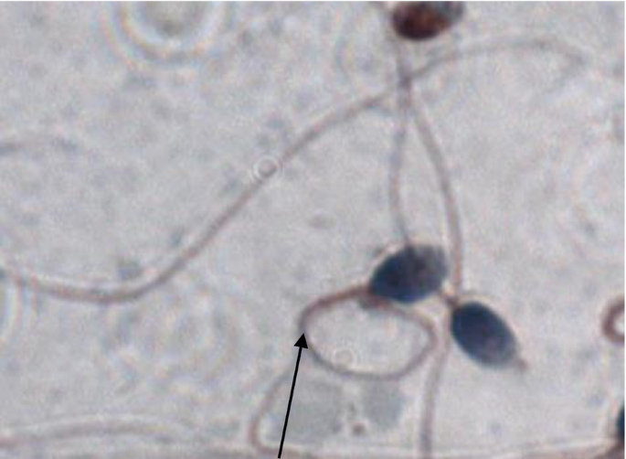 <p>Coiled Tail sperm</p>