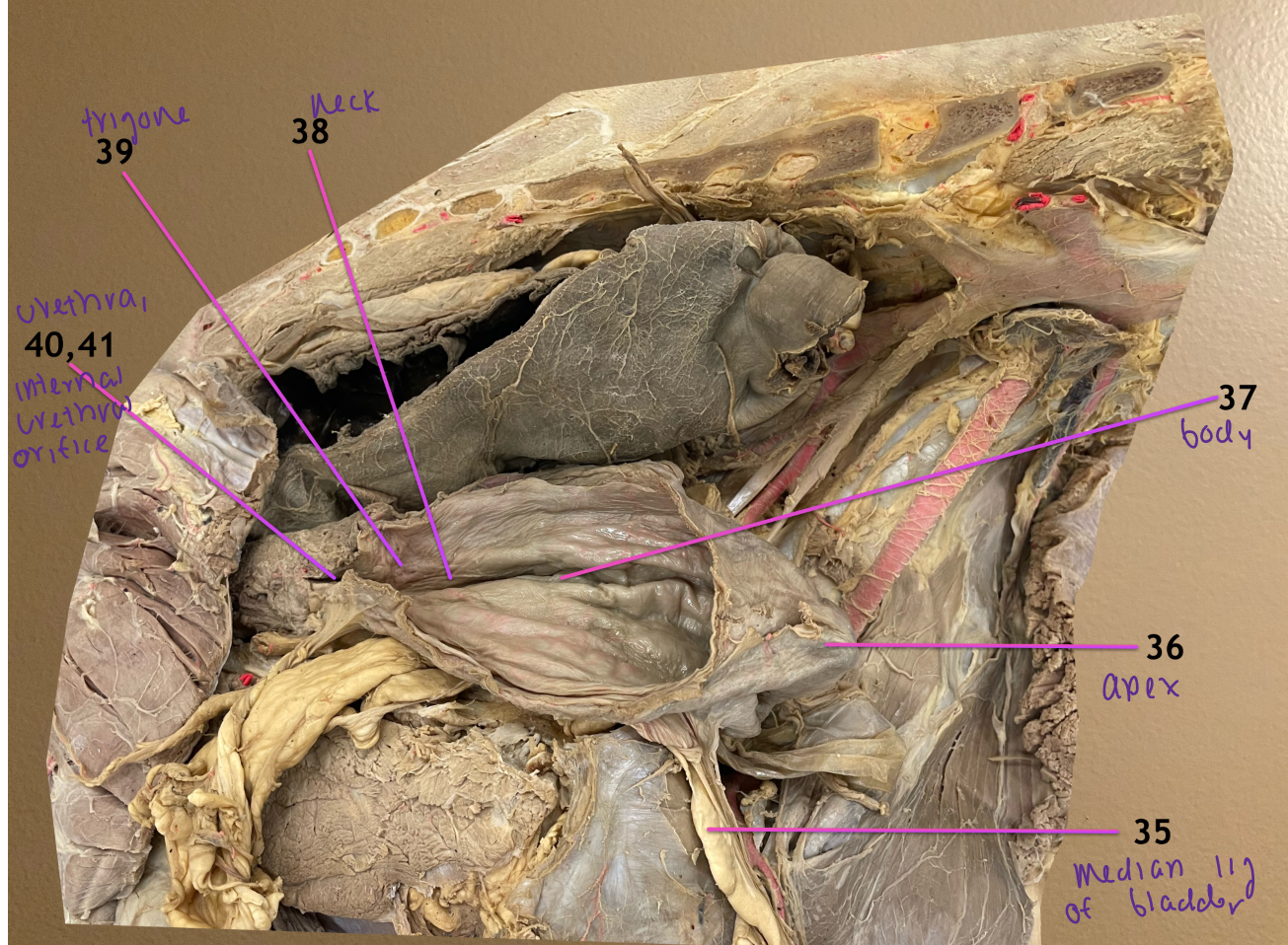 <ol start="36"><li><p>apex of bladder</p></li><li><p>body of bladder</p></li><li><p>neck of bladder</p></li><li><p>trigone of bladder</p></li></ol><p>.</p><ol start="40"><li><p>urethra</p></li><li><p>internal urethral orifice </p></li></ol><p></p>