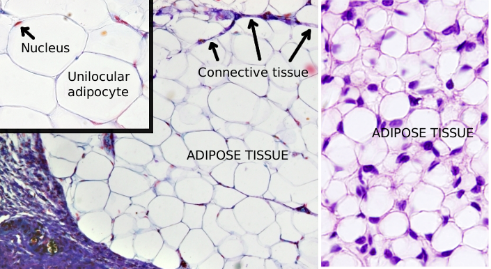 <p>Unilocular Adipose Tissue</p>