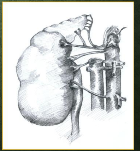 <p>Approximately how many kidneys are supplied by multiple arteries?<br>→ 1/3</p><p>What is main renal artery duplication?<br>→ Two main renal arteries supplying the kidney</p><p>What are accessory renal arteries?<br>→ Additional arteries supplying the kidney</p>