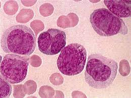 <p>myeloid cells with faint granules and tons of WBCs</p>