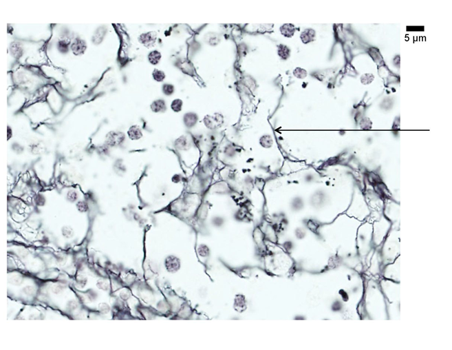 <p>A25) Below is a tissue preparation of a lymph node labelled with silver stain. What is the main type of collagen that is found in the structure that the arrow points to?</p>