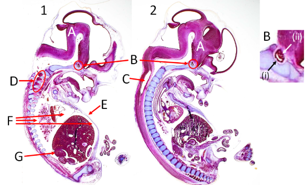 <ol><li><p>Which image is more parasagittal?</p></li><li><p>Label A, B, C, D, E, F and G</p></li><li><p>What part of the pituitary gland is i and ii?</p></li></ol><p></p>