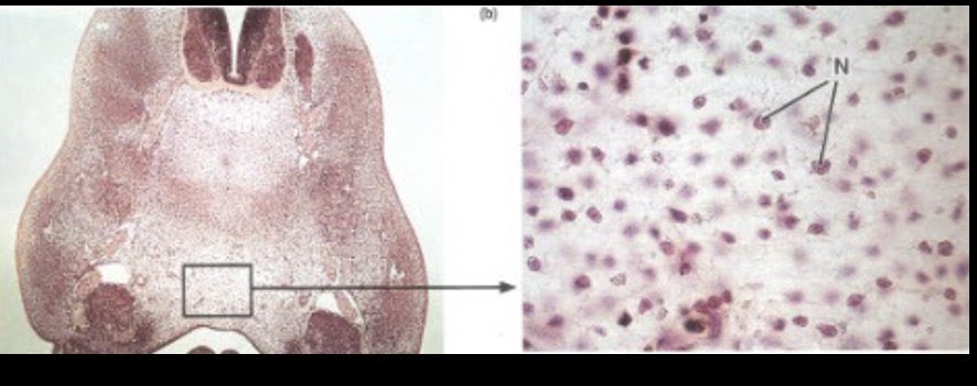 <p>What is the type tissue in this image?</p>