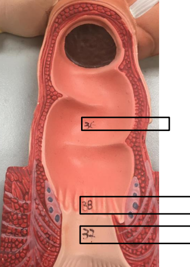<p>Label this image.</p>