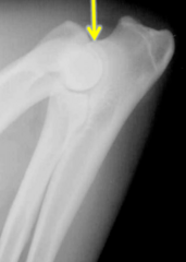 <p>This is a flexed lateral view of what?</p>