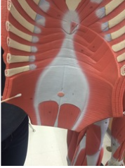 <p>What muscle do you see on the internal abdominal wall?</p>