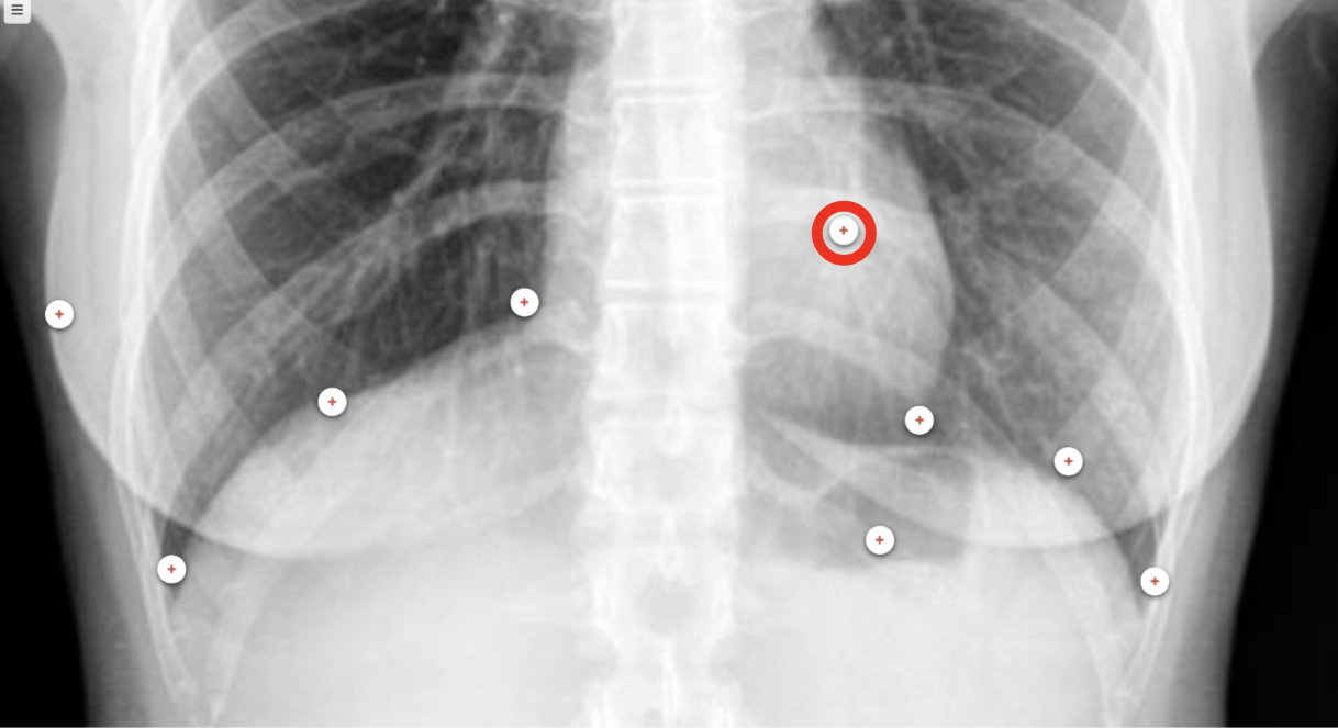 <p>what structure is the red circle labeling?</p>