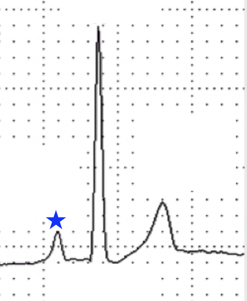 <p>What wave is indicated by the blue star?</p>