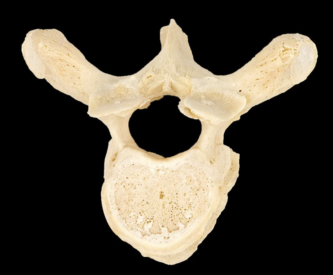 <p>What type of bone is this?</p>