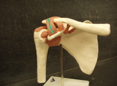<p>Coracoacromial Ligament</p>