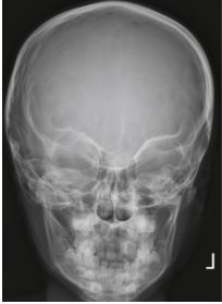 <p><span style="background-color: transparent;">PA Caldwell skull</span></p>