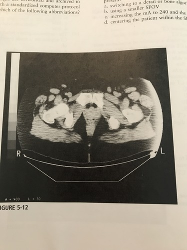 <p>The artifact present on the lateral borders of the image in the figure most likely represent which of the following?</p><p>A) edge gradient </p><p>B) out of field artifact</p><p>C) tube arcing</p><p>D) beam hardening</p>