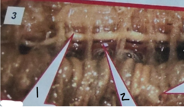 <p>What is point 2 on this earthworm </p>