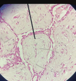 <p>tb?bệnh?</p>