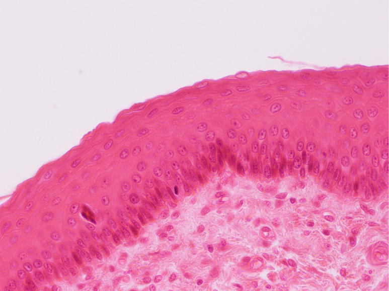 <p>What type of epithelial tissue is this</p>