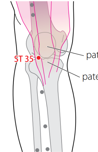 term image