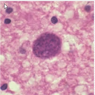 term image