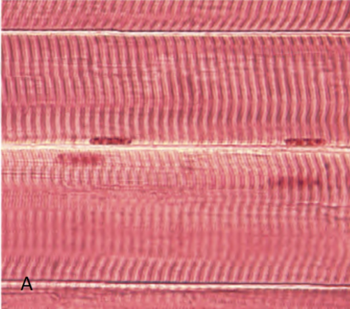 <p>pink vertical lines with 4 dots</p>
