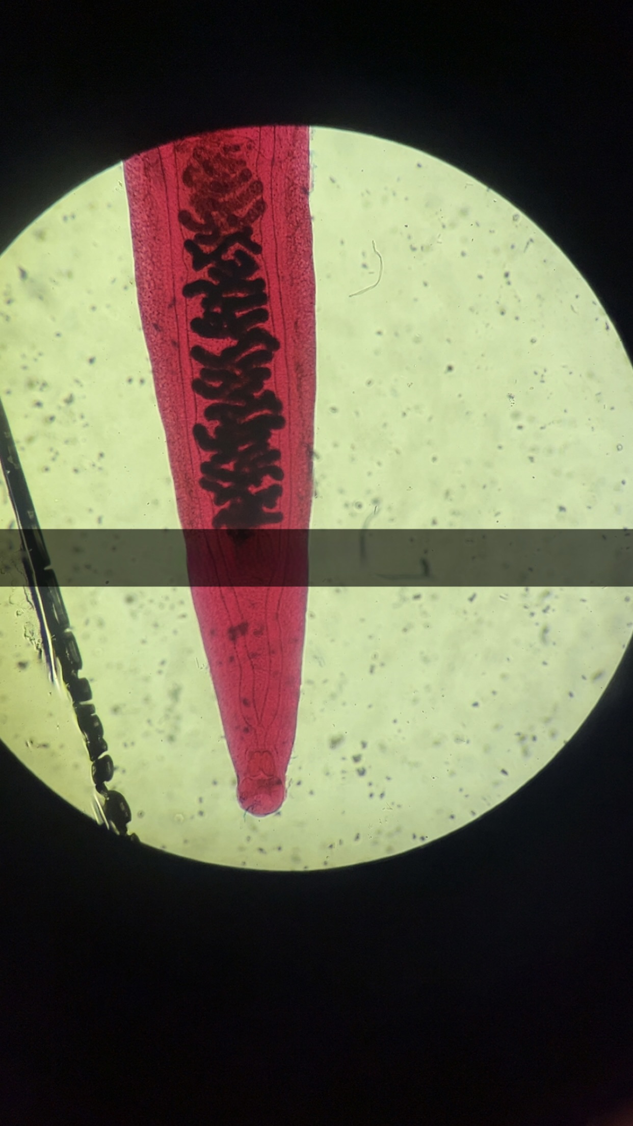 <p>what is this and what is its phylum and class</p>