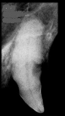 <p>Which tooth resorption stage?</p>
