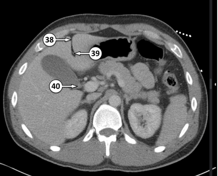 <p>What is 38 and 40?</p>