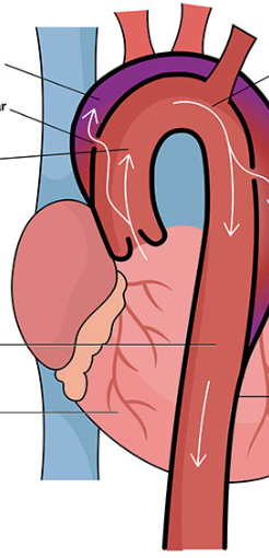 <p>3rd arrow on left</p>