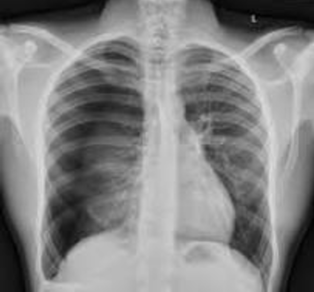 <p>Diagnosis</p>