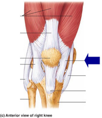<p>A band of connective tissue on the inner side of the patella that helps hold the kneecap in place and prevent excessive movement.</p>