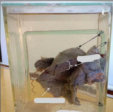 <p>Questions</p><ol><li><p>What organs are included in this specimen?</p></li><li><p>What is the estimated gestational age based on uterus size?</p></li><li><p>What three specific pathological signs are visible on the opened uterine wall?</p></li><li><p>How is the time of death estimated, and what finding supports this?</p></li><li><p>What is the cause of death?</p></li><li><p>What is the final diagnosis?</p></li></ol><div data-type="horizontalRule"><hr></div><p></p><p></p>