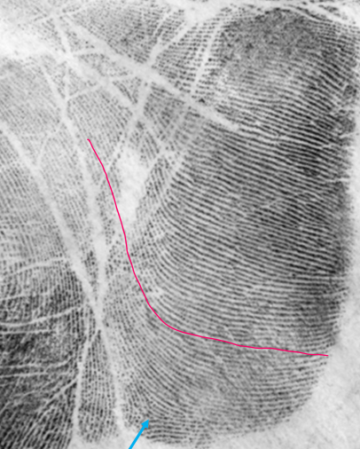 <p>Hypothenar</p><ul><li><p><span style="color: rgb(255, 10, 115);">Down &amp; out ridge flow</span></p></li><li><p>Outward nose loop</p></li><li><p><span style="color: rgb(45, 162, 218);">Carpal delta</span></p></li></ul><p></p>