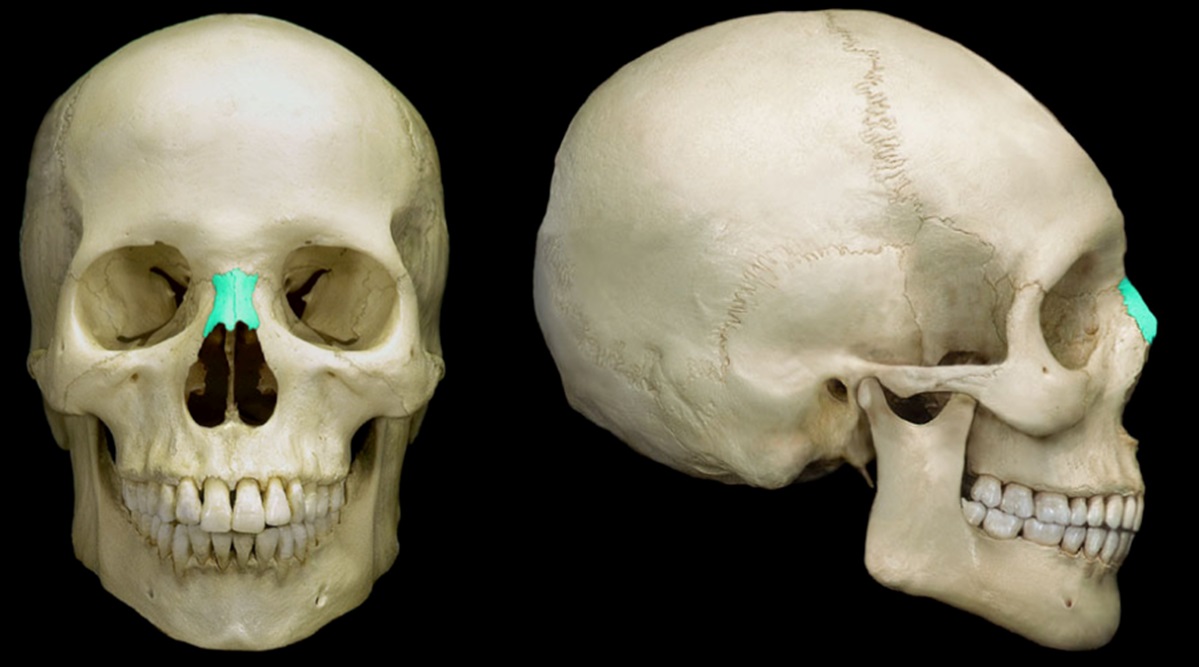 <p><br><strong>[Identify the bone]</strong></p>