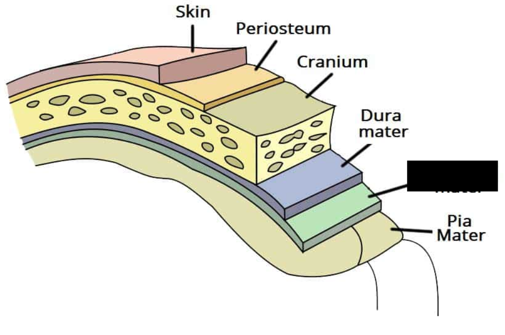 <p><span style="background-color: transparent;">The middle layer of the meninges is known as the <strong>_________ _____</strong>, which is a thin layer consisting of simple squamous epithelum. It adheres to the inner portion of the dura mater.</span></p>