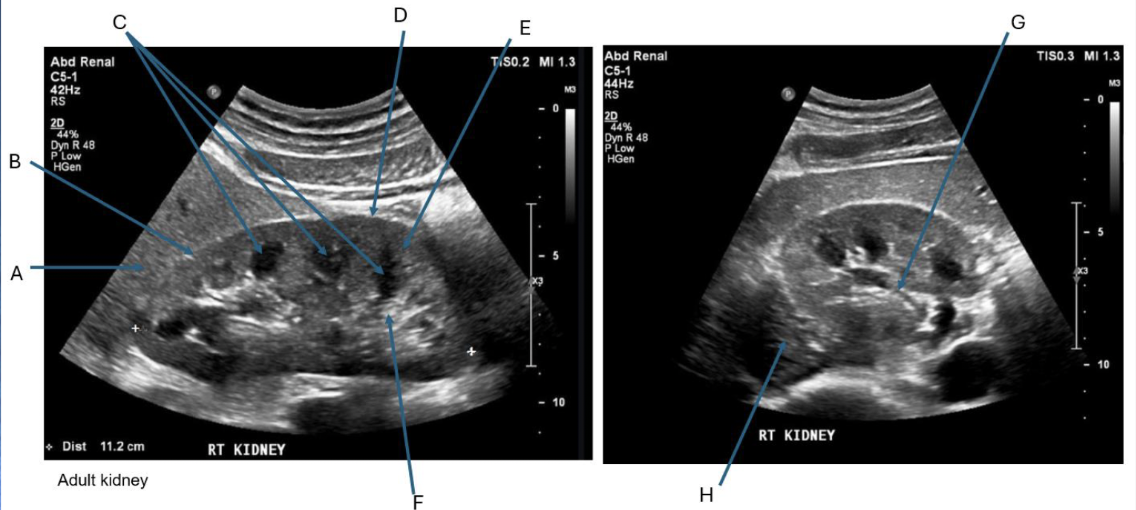 <p>Label + Which is Long/TRV</p>
