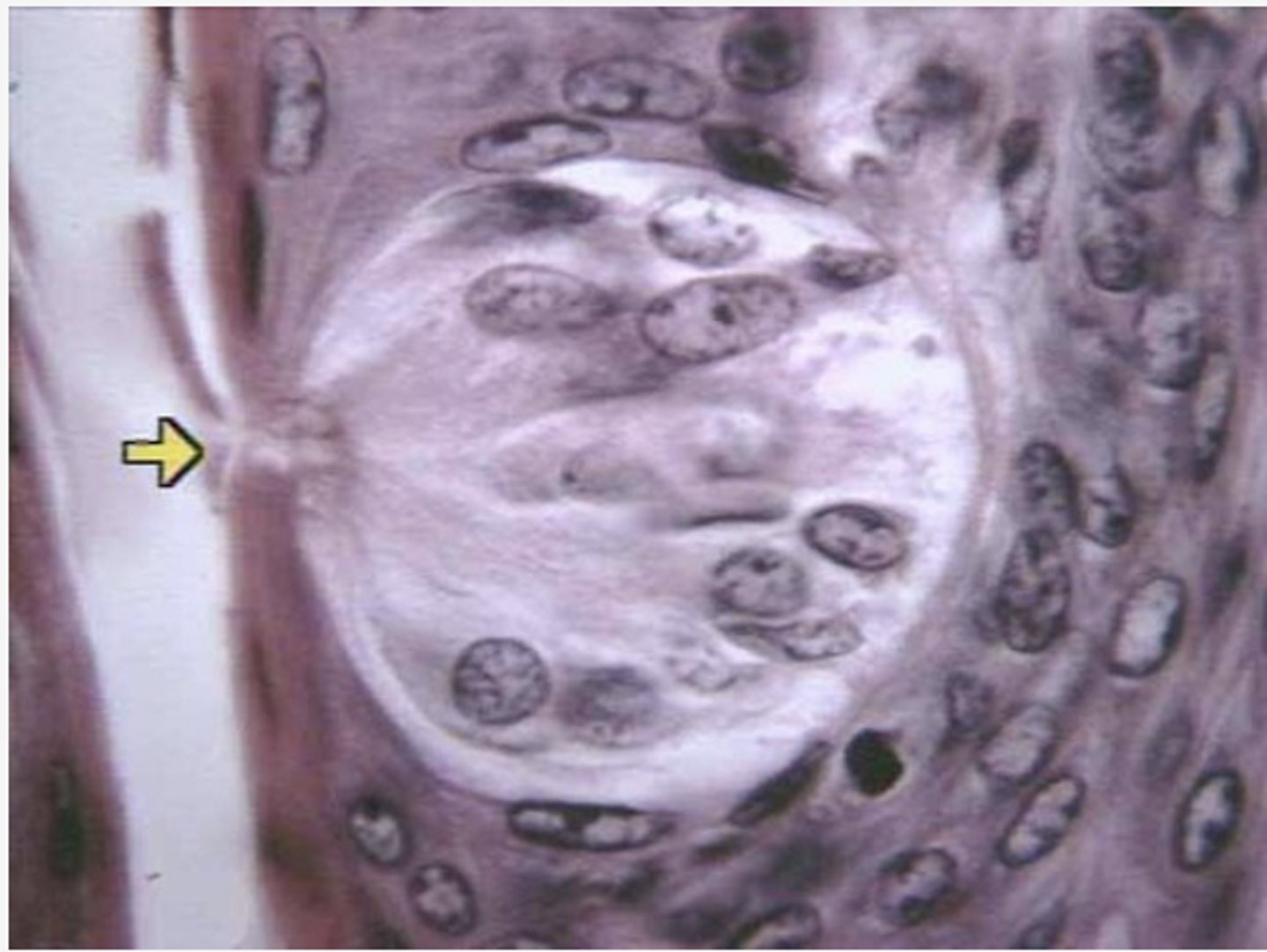 <p>Identify the following structure</p>