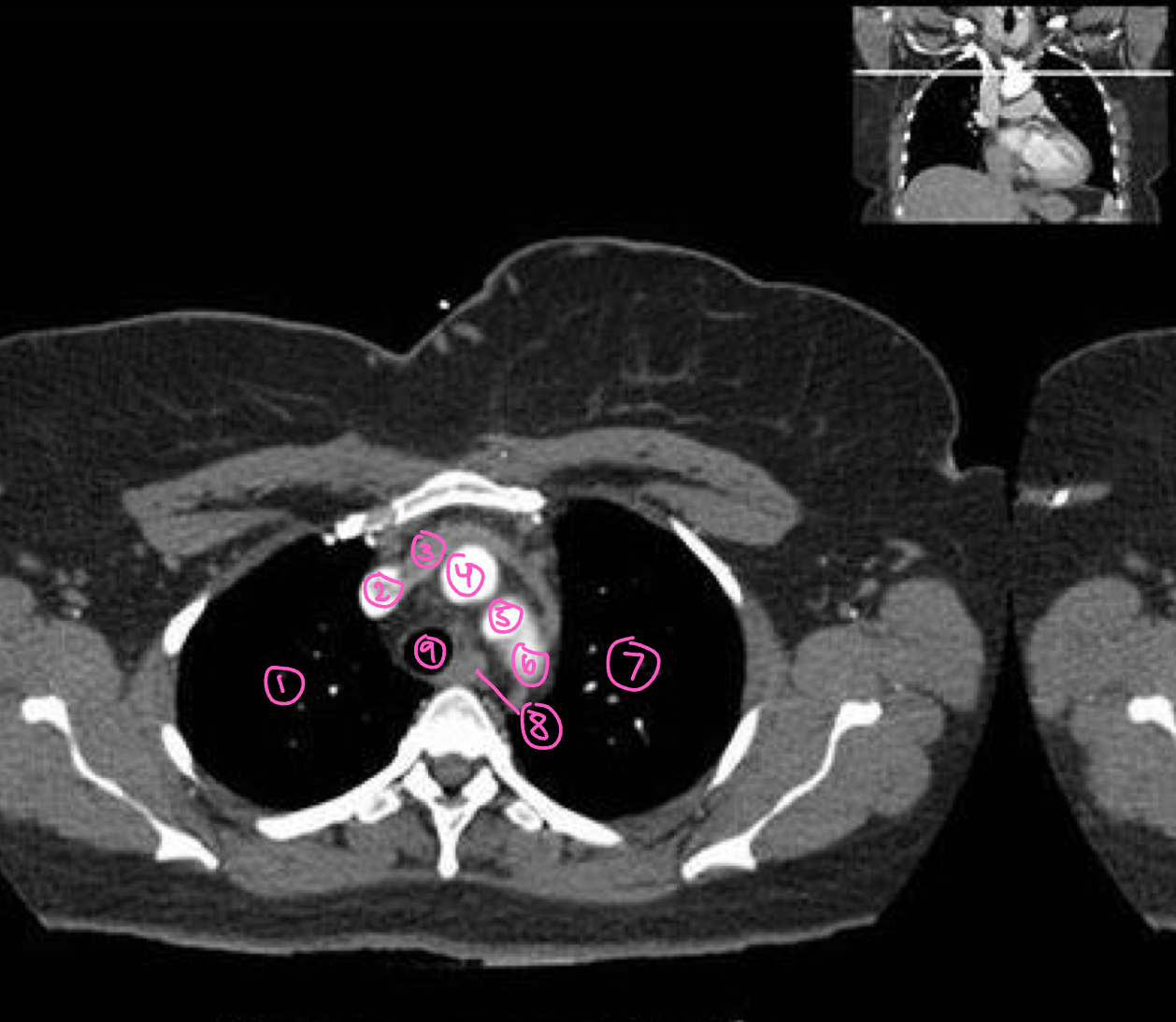 <p>The structure labeled 5 in this image is:</p>