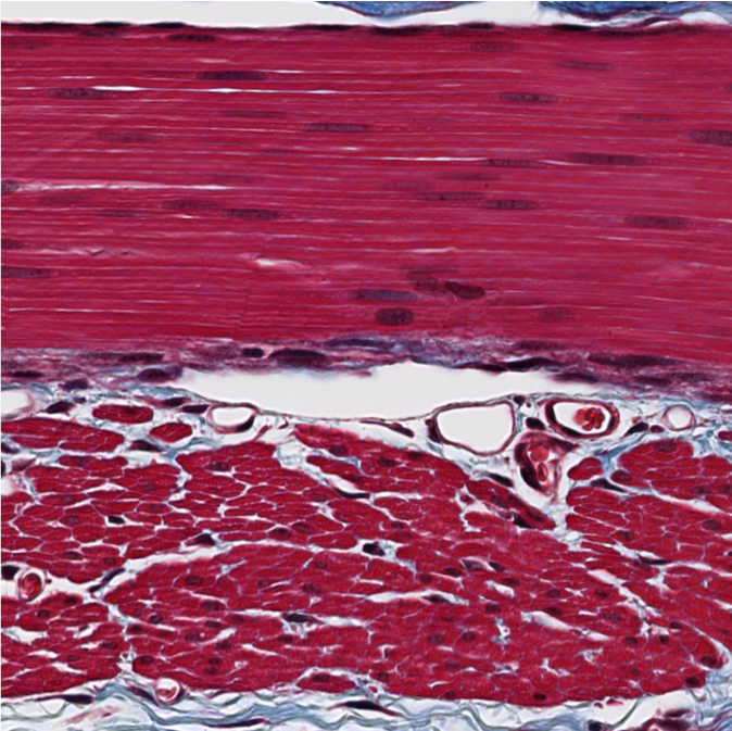 <p><span style="font-family: "Calibri Light";">ID the type of muscle.</span></p>
