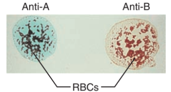 <p>what blood type is this #1</p>