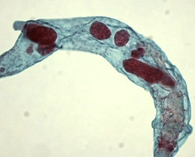 <p>What helminth/fluke/parasitic worm is this?</p>